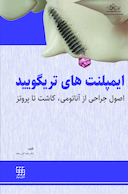 ایمپلنت های تریگویید اصول جراحی از آناتومی، کاشت تا پروتز